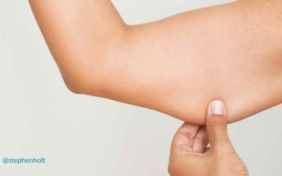 How to Get Rid of Jiggly Arms after Menopause