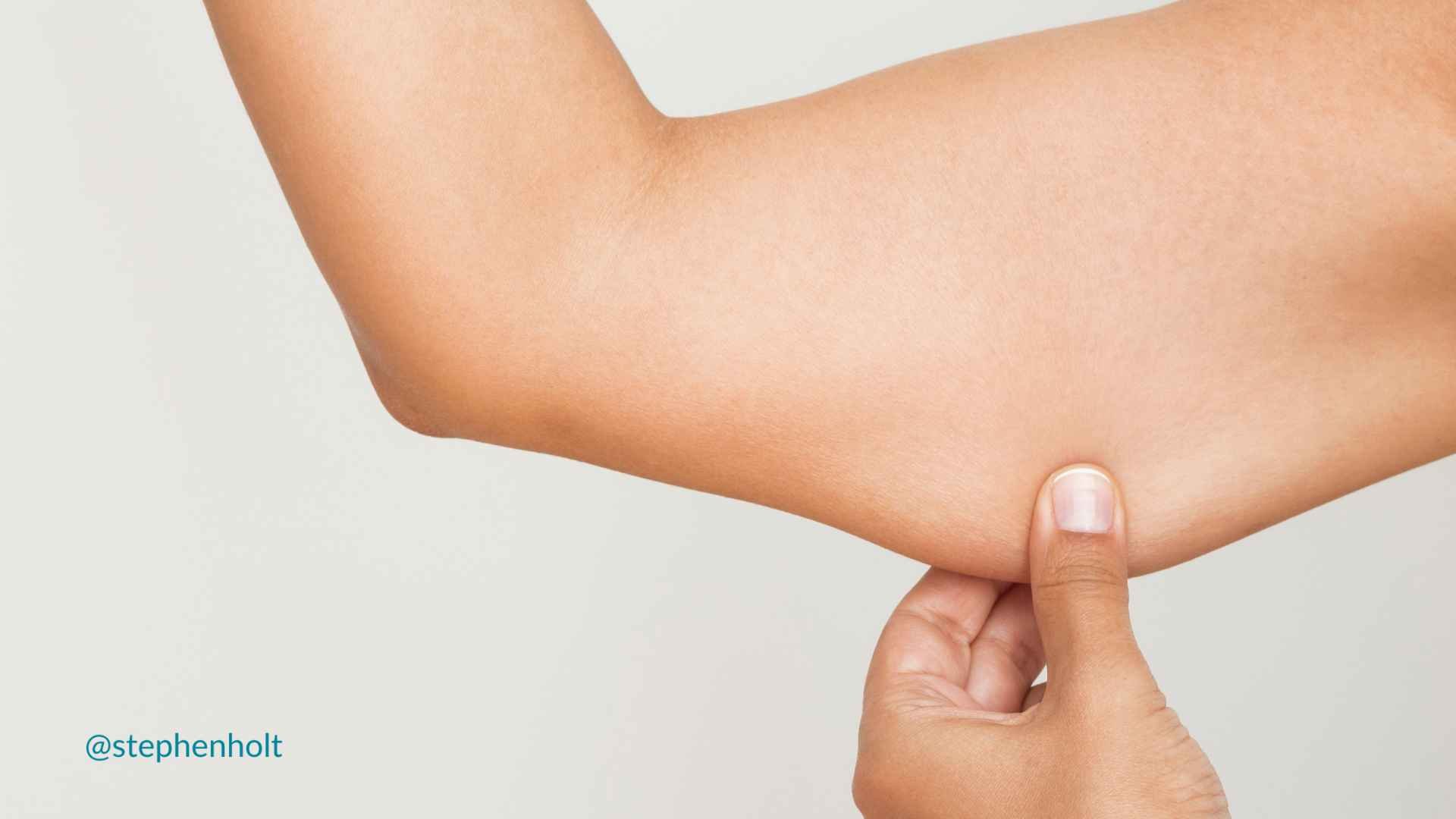 jiggly arms